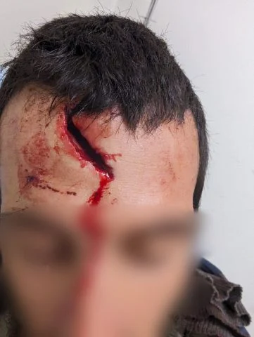 The Israeli who was injured