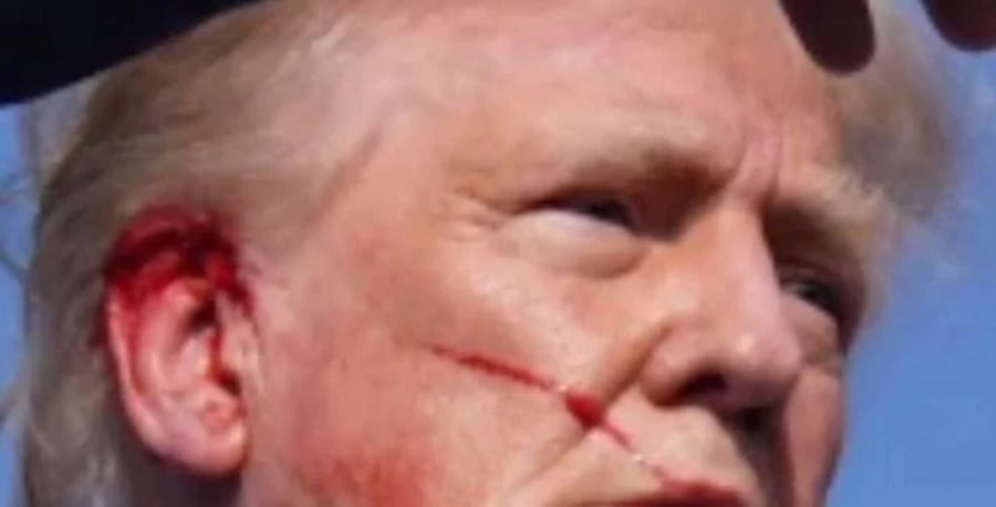 Donald Trump, immediately after an assassination attempt on his life