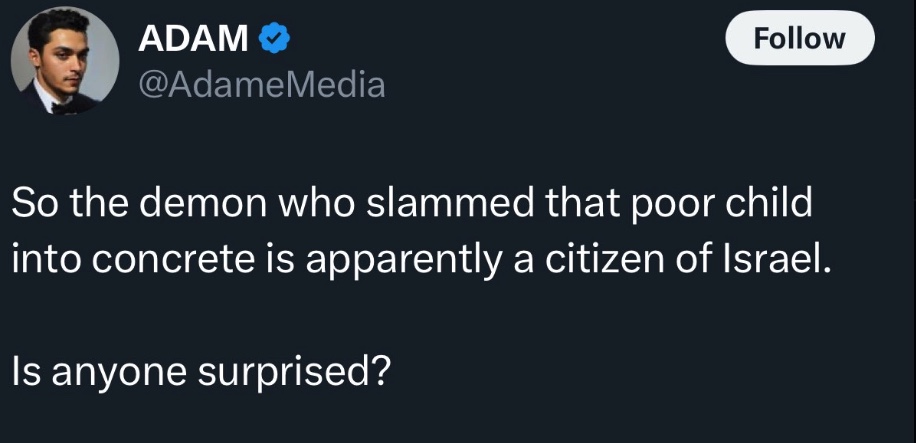 GRAPHIC: Belarusian man assaults 2 year old child, and puts him in a coma: The world blames the Jews