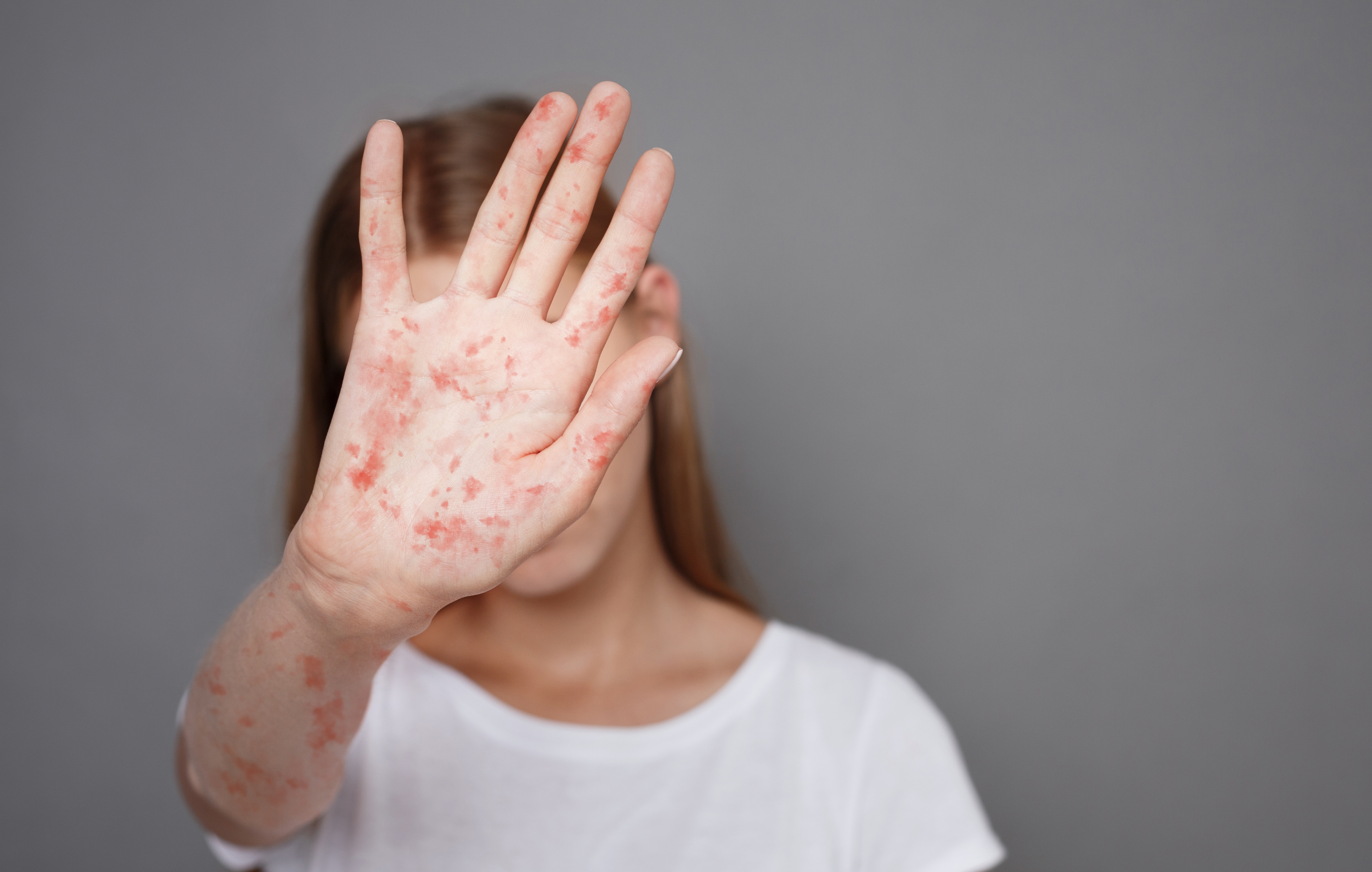 Girl With Virus Closing Face Over Grey Background