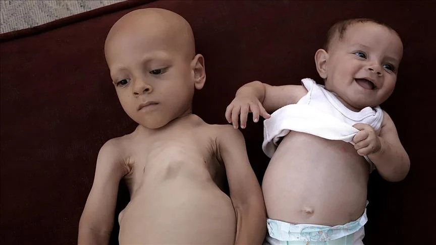 Photos of the child Abdallah al-Hani Mohammed Abu Zarqa published on social media