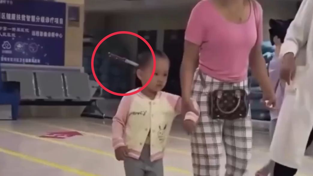 The 3 year old girl entering hospital with a knife in her head