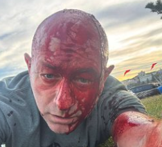 Arsen Ostrovsky was injured in Chabad Chanukah party shooting