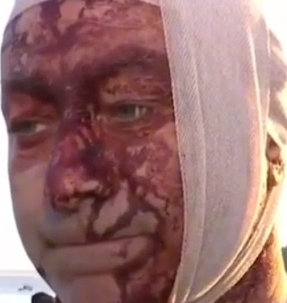 Arsen Ostrovsky injured in today's terror shooting