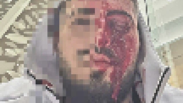 Israeli man attacked in Cyprus, December 2025