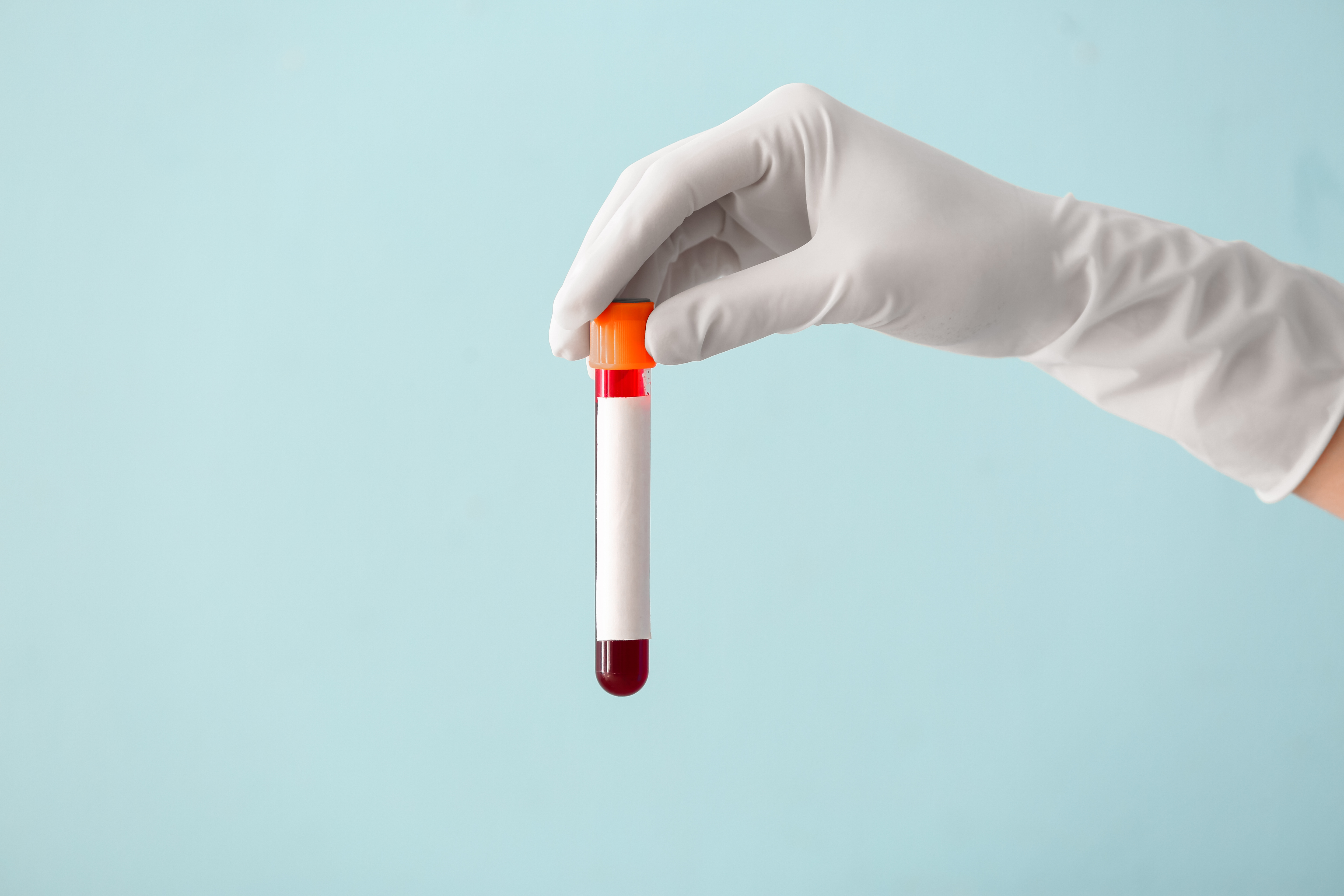 Test tube (illustrative)