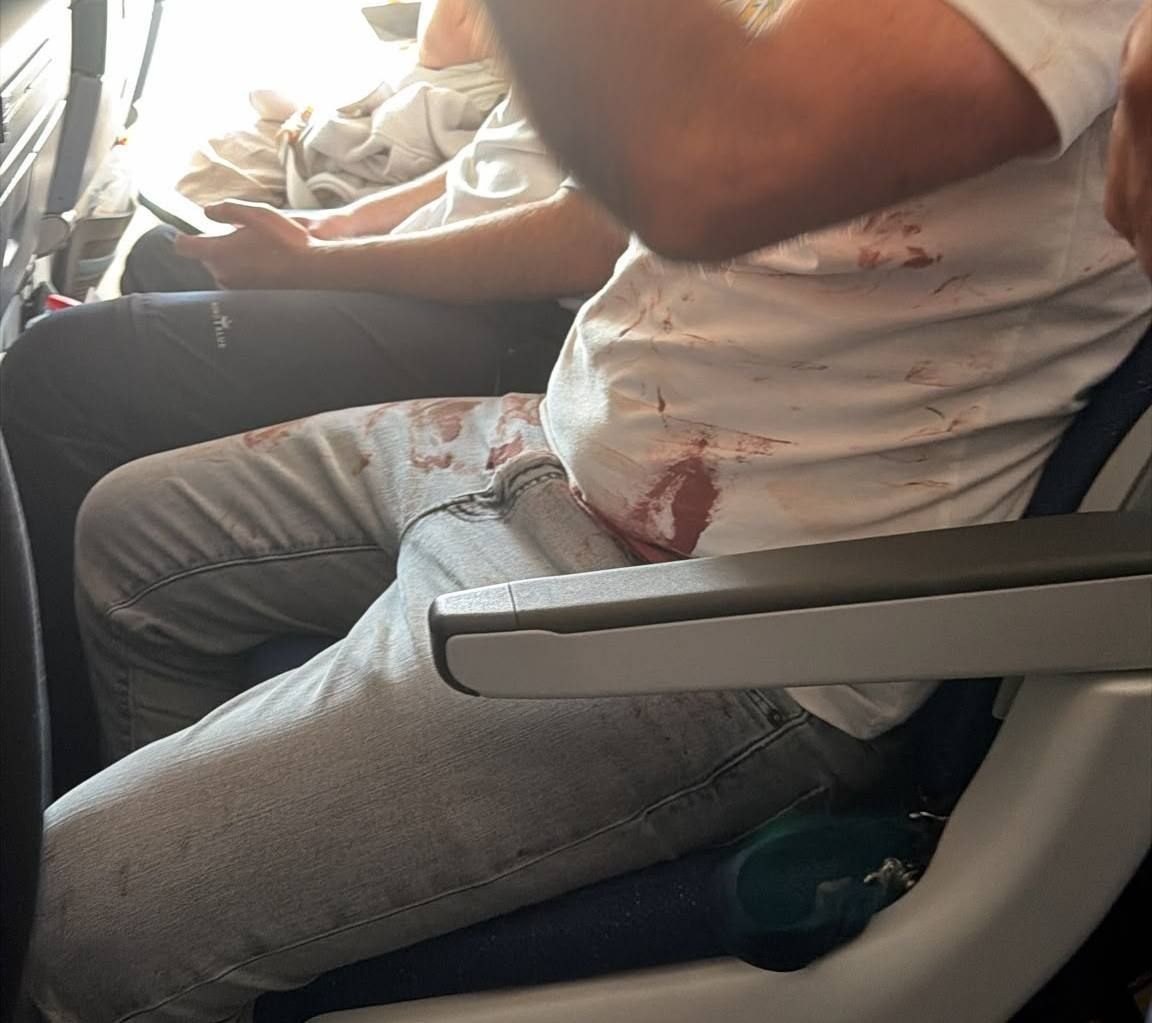 Bloodied passenger aboard the aircraft
