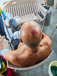 Two Minors Arrested After Brutal Assault on 64-Year-Old Driver in Kiryat Gat