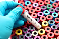 Test tube showing result: Positive for rabies
