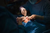 Rhinoplasty