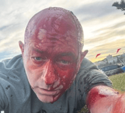 Arsen Ostrovsky was injured in Chabad Chanukah party shooting