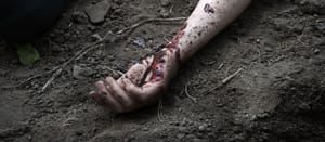 Illustrative: Man's arm covered in blood.