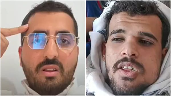 Yemeni Sunni Who Hates the Houthis: We'll Step on Israel's Neck