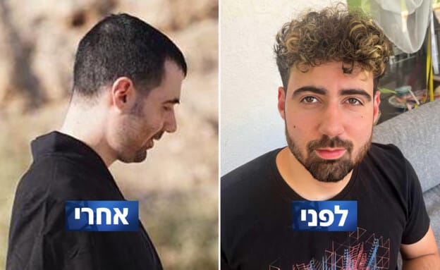 Hostage Guy Gilboa Dalal before and after Hamas captivity