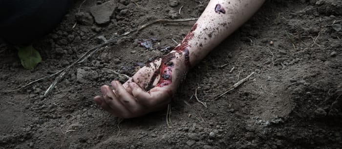 Illustrative: Man's arm covered in blood.