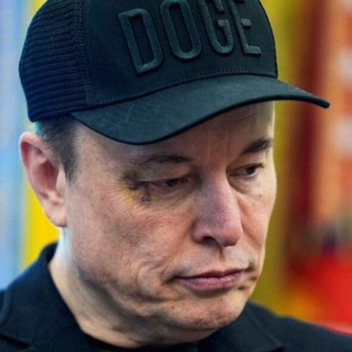 Elon Musk with a black eye