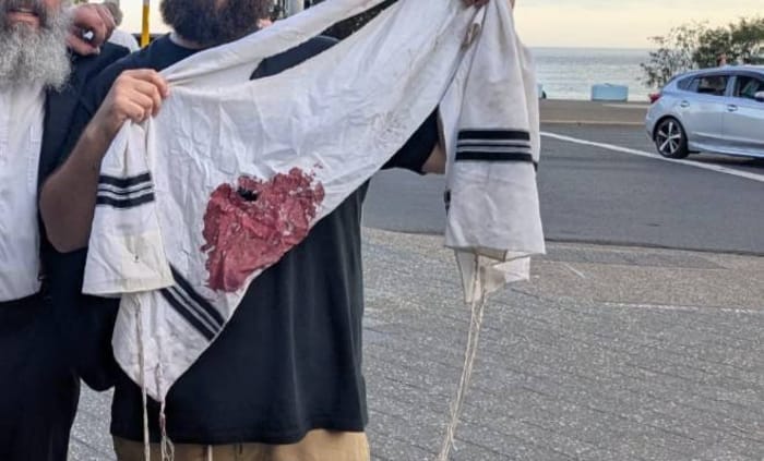 Blood-stained Tallis, Bondi Beach, 14 December 2025