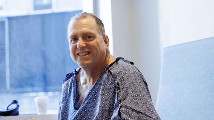 Timothy, four days after the transplant.