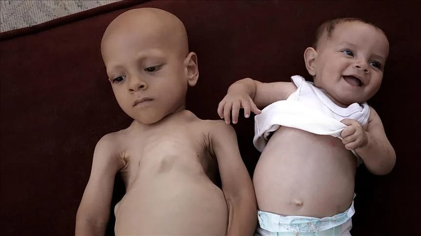 Photos of the child Abdallah al-Hani Mohammed Abu Zarqa published on social media