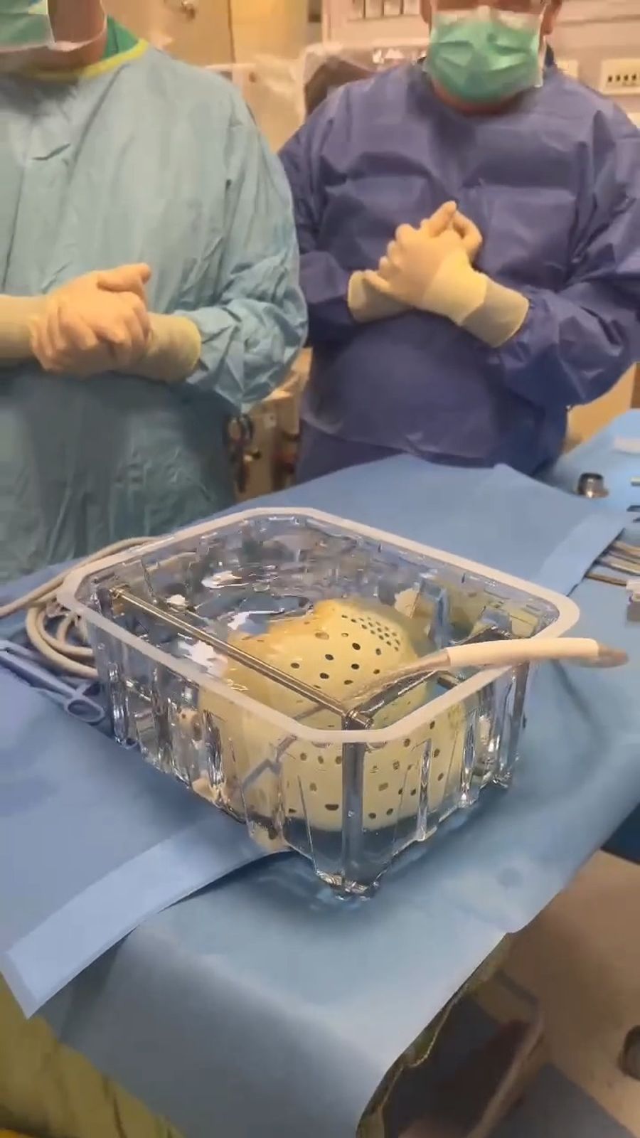 The increadible artificial heart transplant