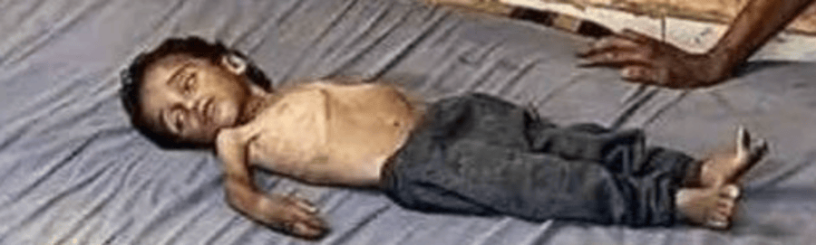 Hamas’ Lies Exposed: New “Hungry Child” Image Debunked