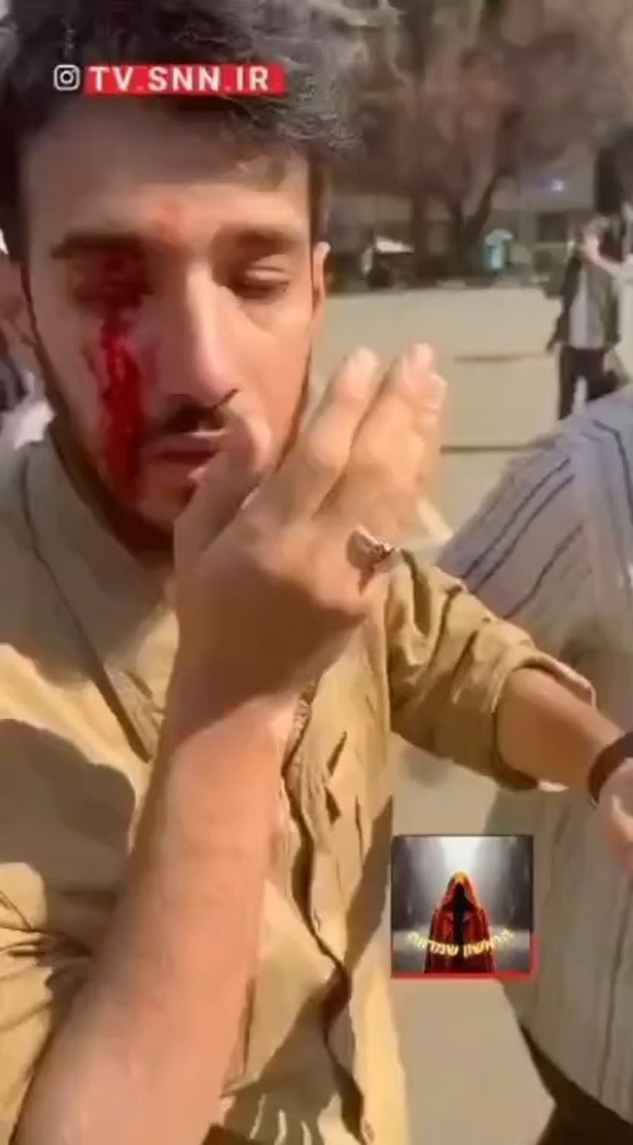 Protester injured by IRGC