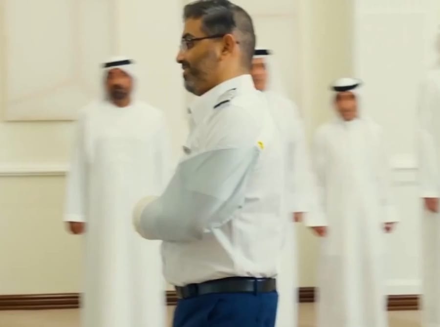 With visible scars: The pilot received an award from the UAE president