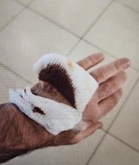 Injured hand