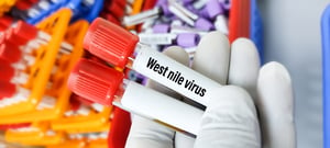 Blood sample for West Nile Virus testing, mosquito-borne disease in the continental US