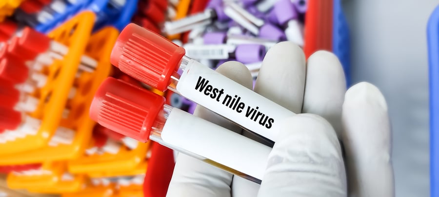 Blood sample for West Nile Virus testing, mosquito-borne disease in the continental US