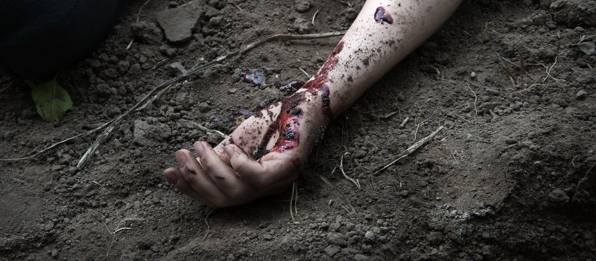 Illustrative: Man's arm covered in blood.