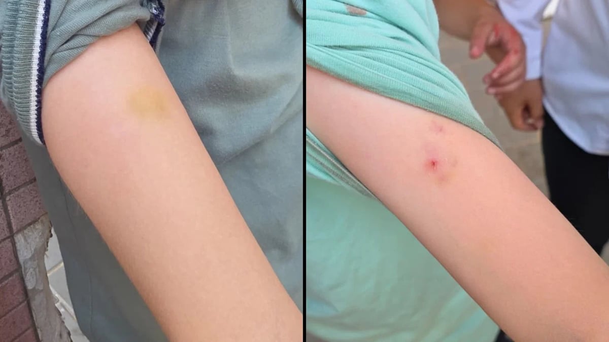 Bnei Brak Teacher Admits Assaulting Students, Returns to Classroom After One-Day Suspension