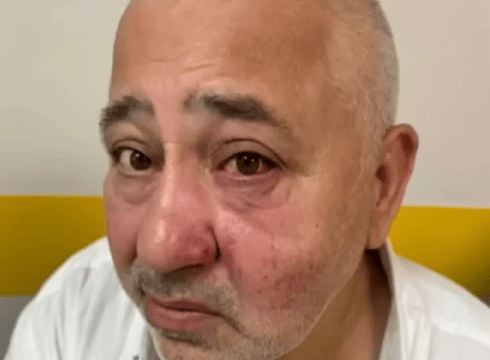 Dubi Sitruck after the attack