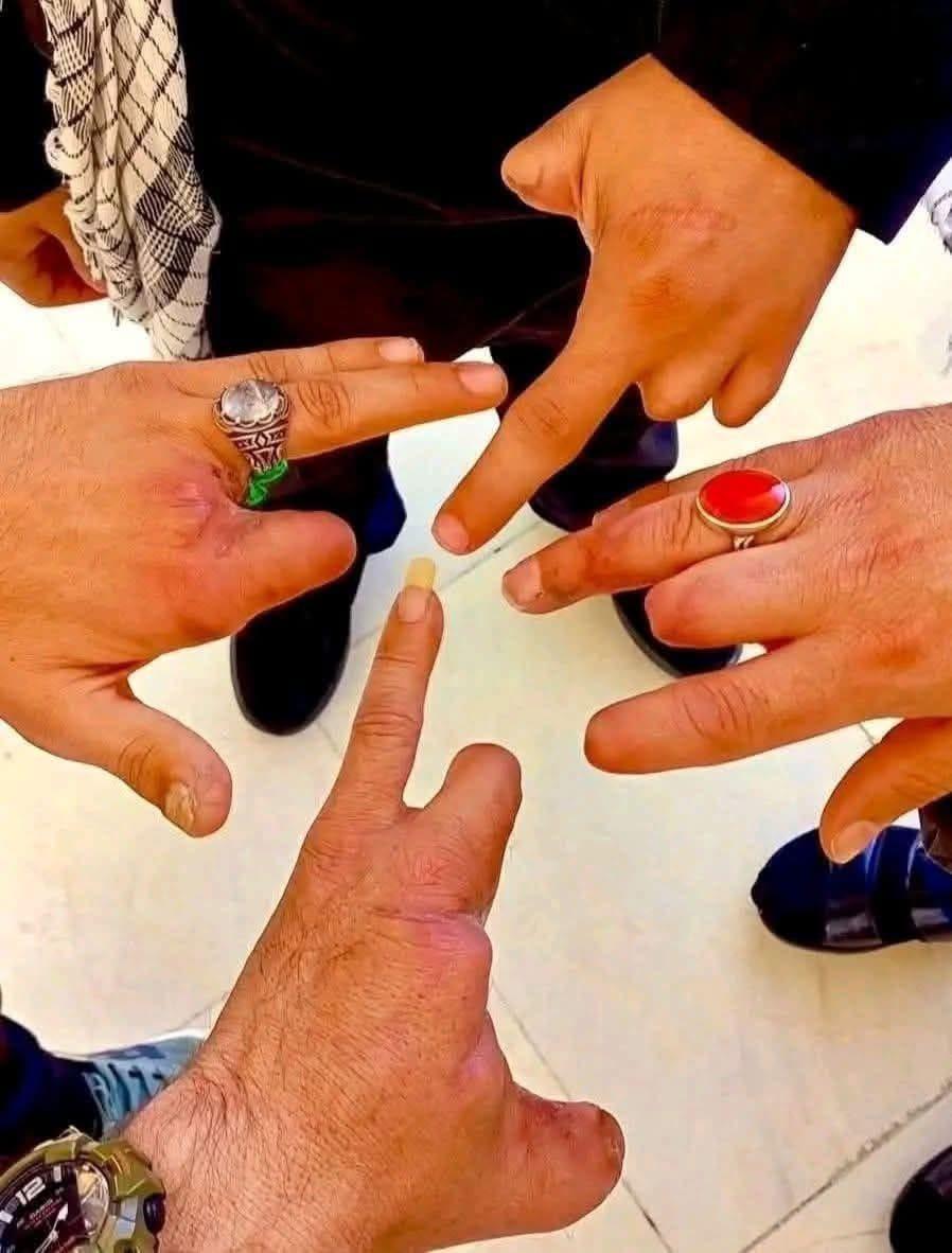 Hezbollah members after the pager attacks