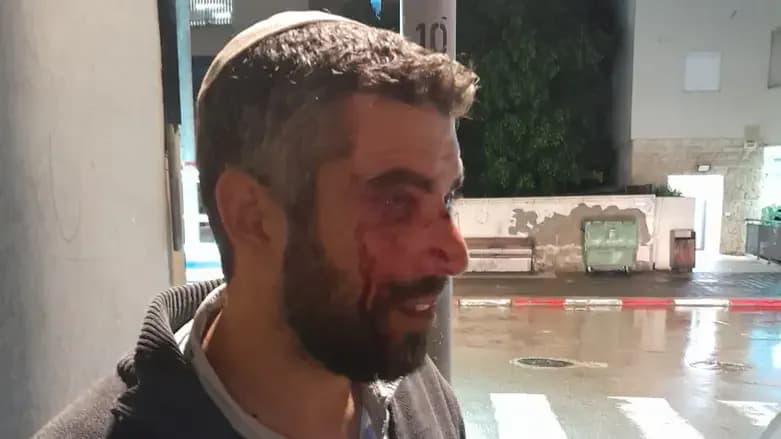 Rabbi Netanel Avitan after he was attacked