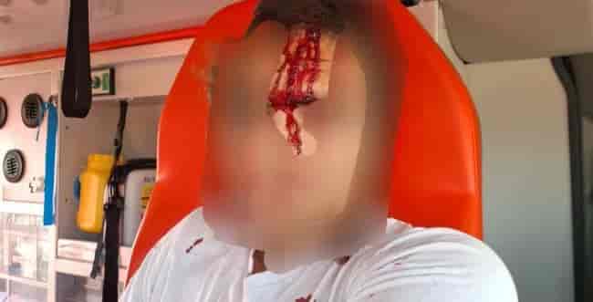The injured in the attack this morning background