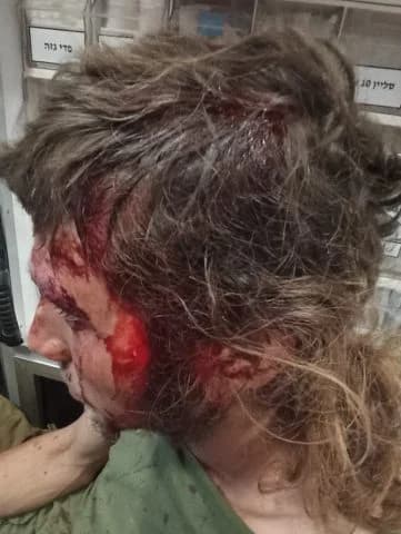 The man wounded in the lynching The man wounded in the lynching