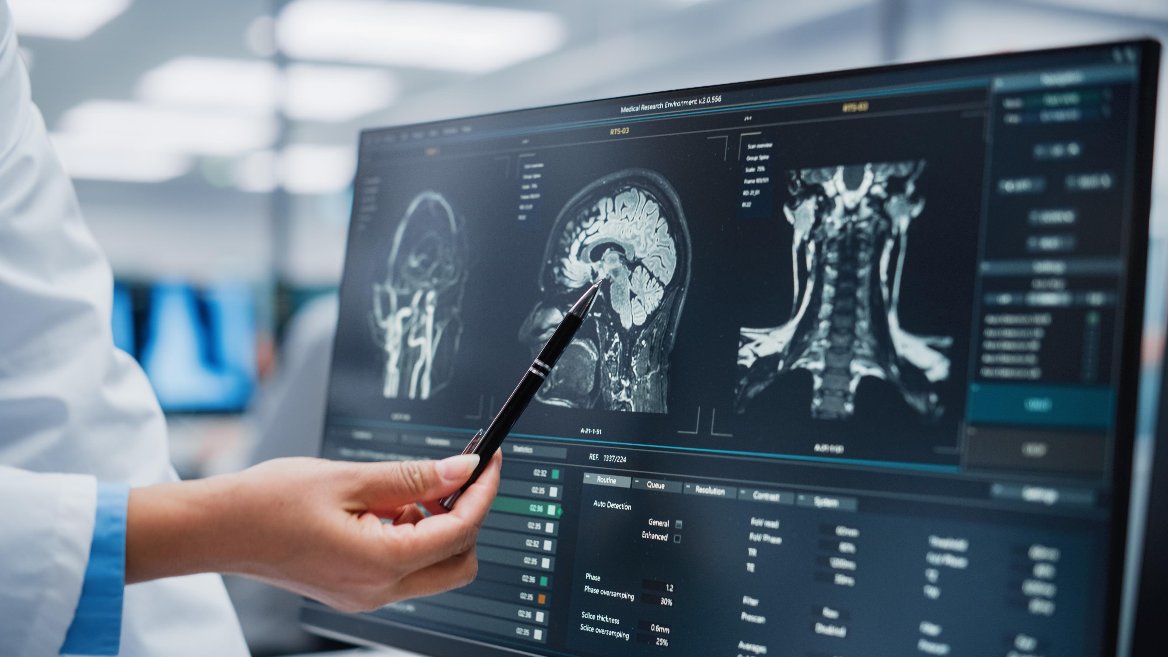 Brain disease hospital research
