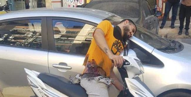 Hezbollah militant after the exploding pagers attack Hezbollah militant after the exploding pagers attack