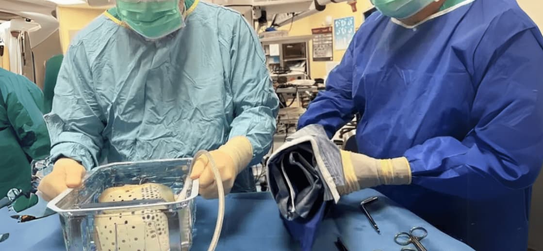 The increadible artificial heart transplant