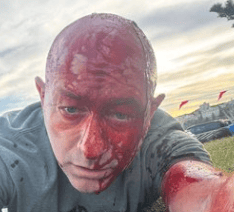 Arsen Ostrovsky was injured in Chabad Chanukah party shooting