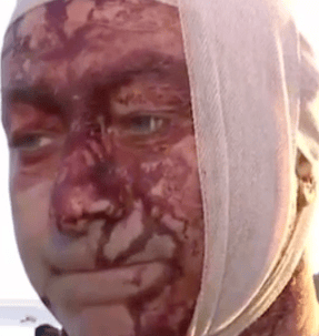 Arsen Ostrovsky injured in today's terror shooting